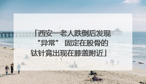 西安一老人跌倒后发现“异常” 固定在股骨的钛针竟出现在膝盖附近